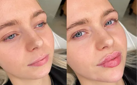 Clinic Galata | Sculptra, Liquid Facelift & Medical Aesthetic Clinic Istanbul